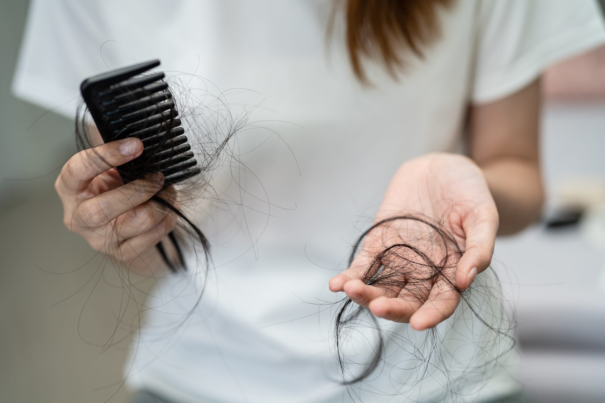 Person experiencing hair shedding